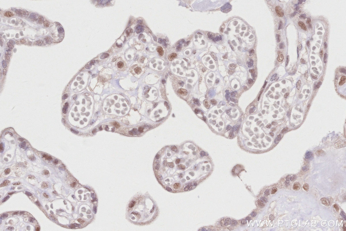 Immunohistochemistry (IHC) staining of human placenta tissue using PRMT6 Polyclonal antibody (15395-1-AP)