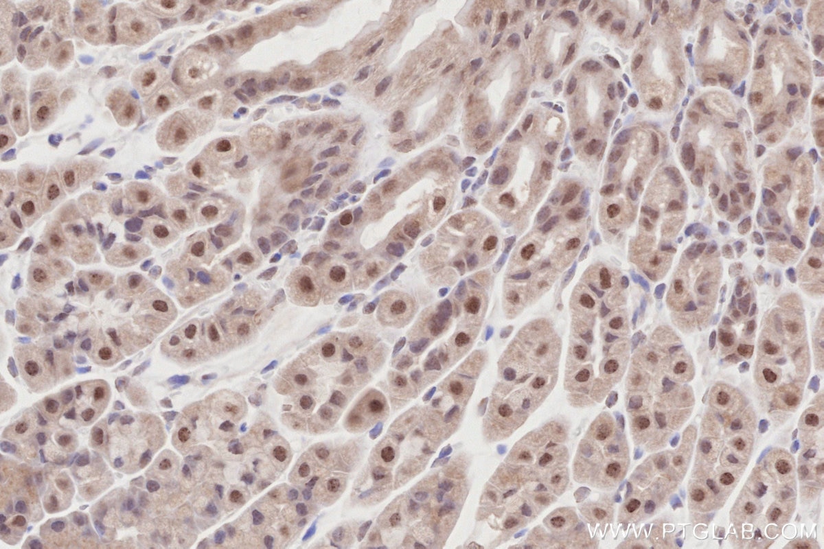Immunohistochemistry (IHC) staining of mouse stomach tissue using PRMT6 Polyclonal antibody (15395-1-AP)