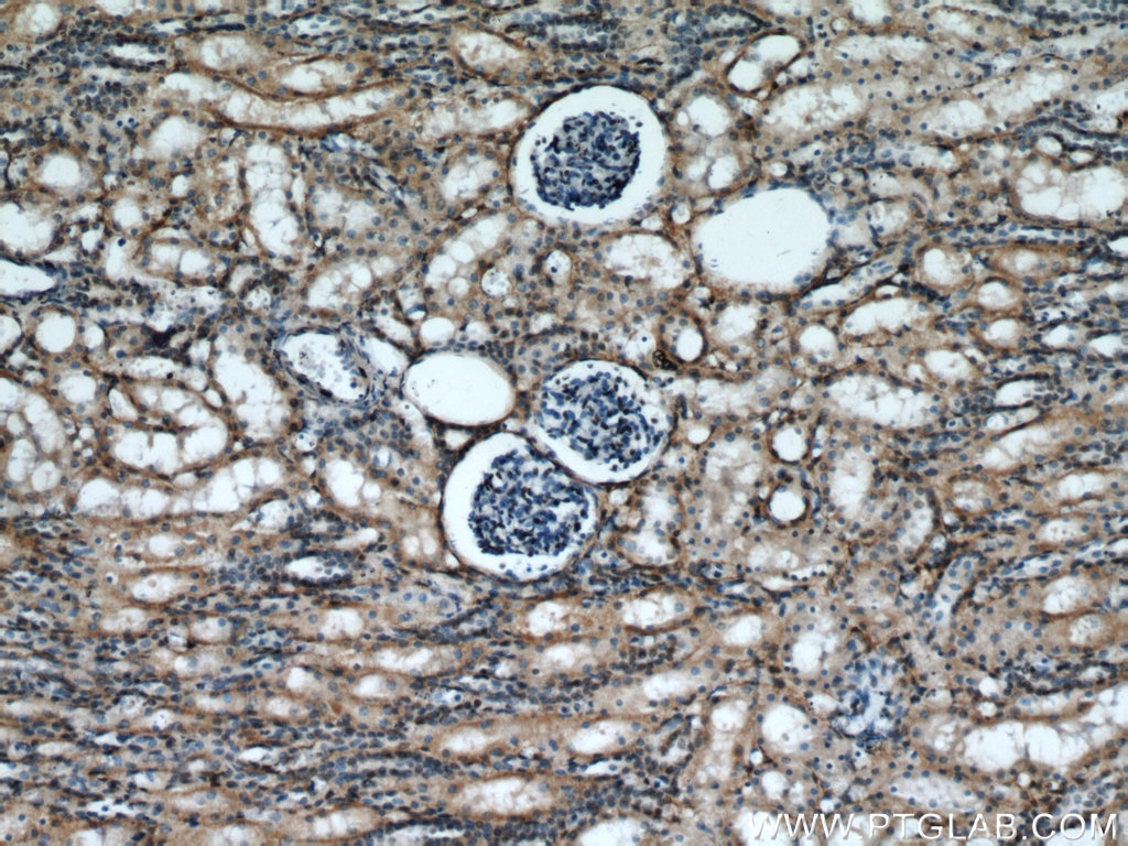 Immunohistochemistry (IHC) staining of human kidney tissue using PRMT6 Polyclonal antibody (15395-1-AP)