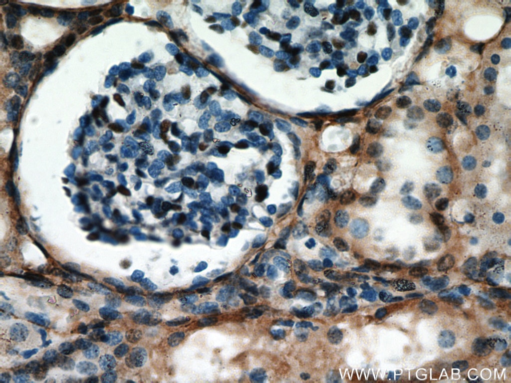 Immunohistochemistry (IHC) staining of human kidney tissue using PRMT6 Polyclonal antibody (15395-1-AP)