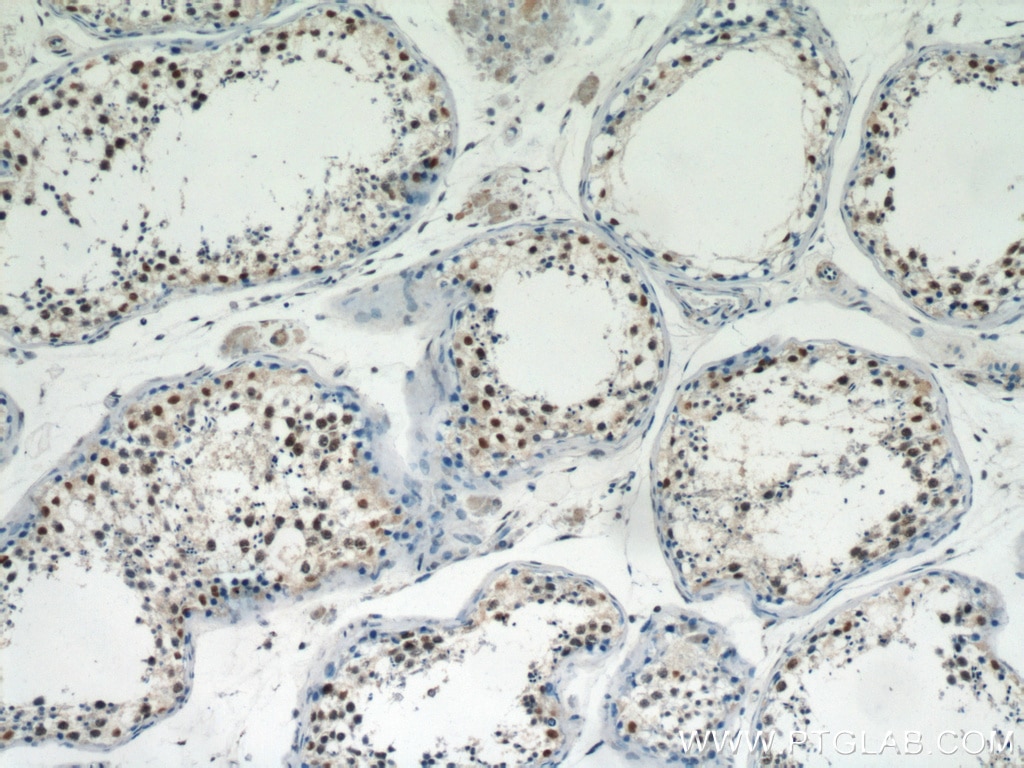 Immunohistochemistry (IHC) staining of human testis tissue using PRMT6 Polyclonal antibody (15395-1-AP)