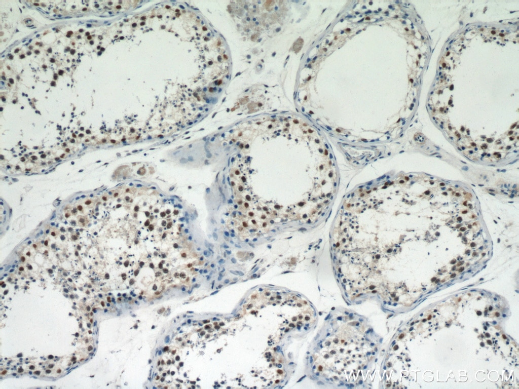 IHC staining of human testis using 15395-1-AP