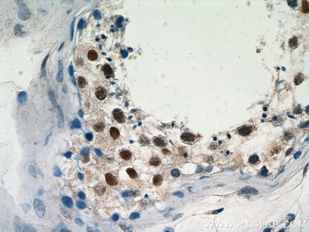 Immunohistochemistry (IHC) staining of human testis tissue using PRMT6 Polyclonal antibody (15395-1-AP)