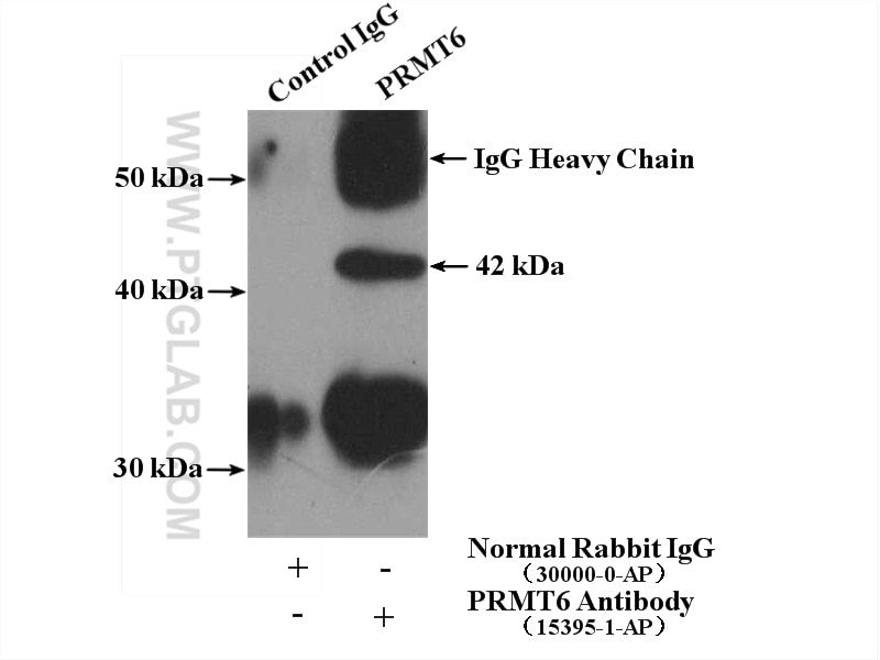 Immunoprecipitation (IP) experiment of HEK-293 cells using PRMT6 Polyclonal antibody (15395-1-AP)