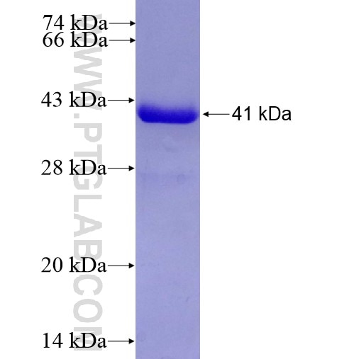 PRMT6 fusion protein Ag7934 SDS-PAGE