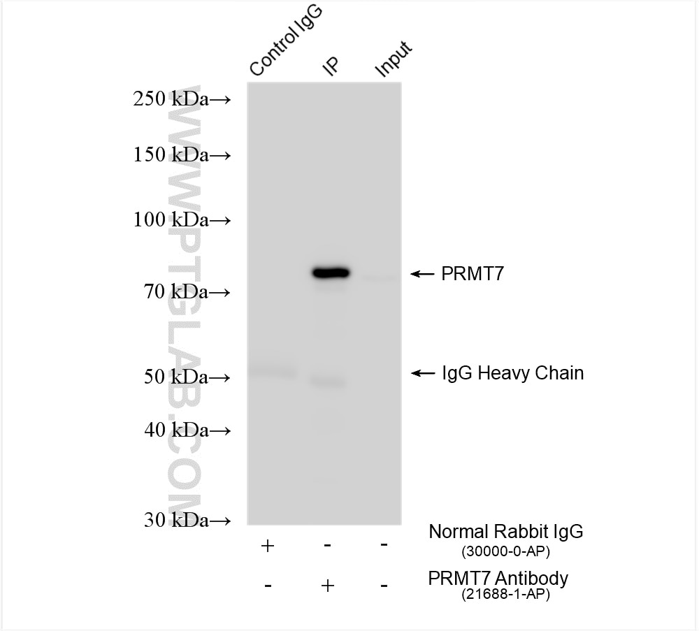 Immunoprecipitation (IP) experiment of HeLa cells using PRMT7 Polyclonal antibody (21688-1-AP)