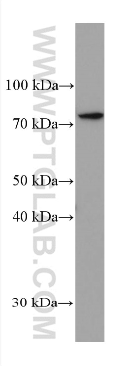 Western Blot (WB) analysis of HSC-T6 cells using PRMT7 Monoclonal antibody (67669-1-Ig)