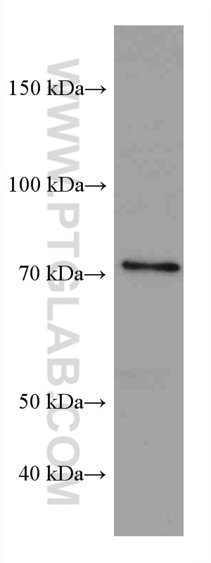 Western Blot (WB) analysis of HepG2 cells using PRMT7 Monoclonal antibody (67669-1-Ig)