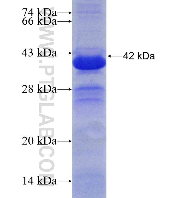 PRMT7 fusion protein Ag30434 SDS-PAGE