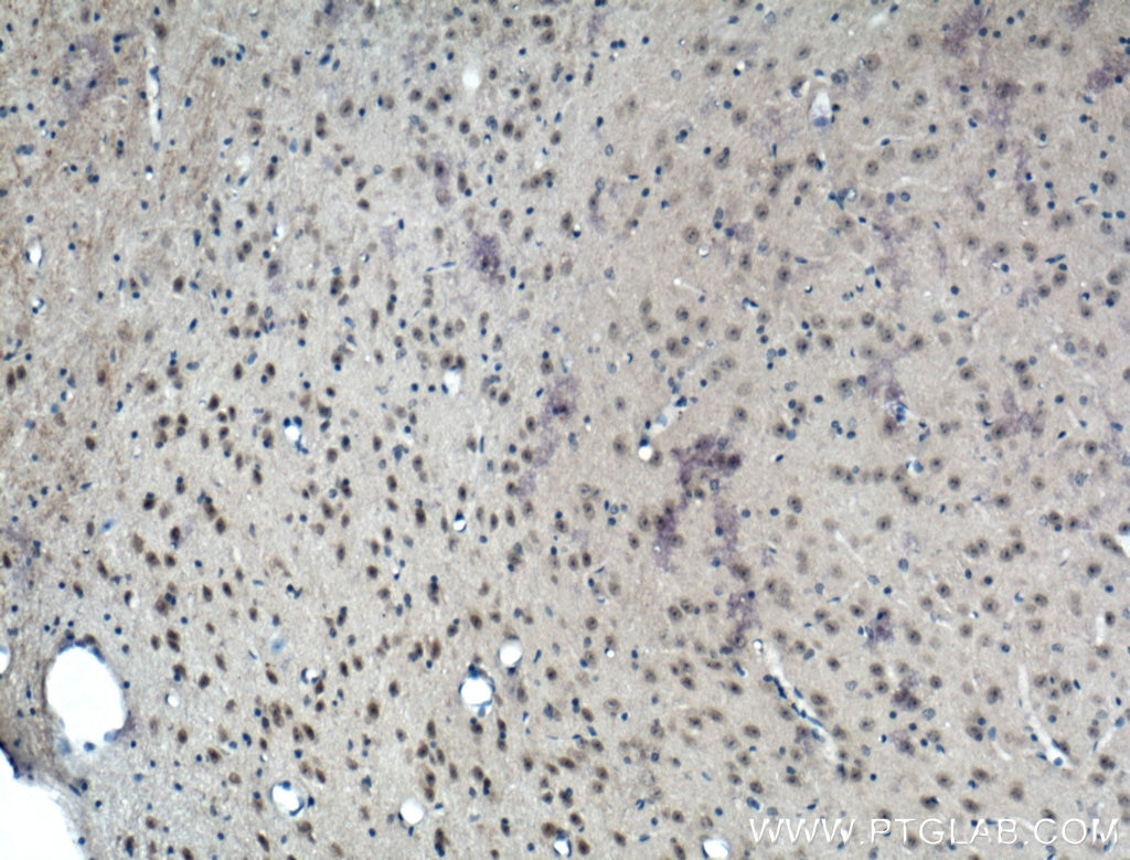 Immunohistochemistry (IHC) staining of mouse brain tissue using PRMT8 Polyclonal antibody (12557-1-AP)