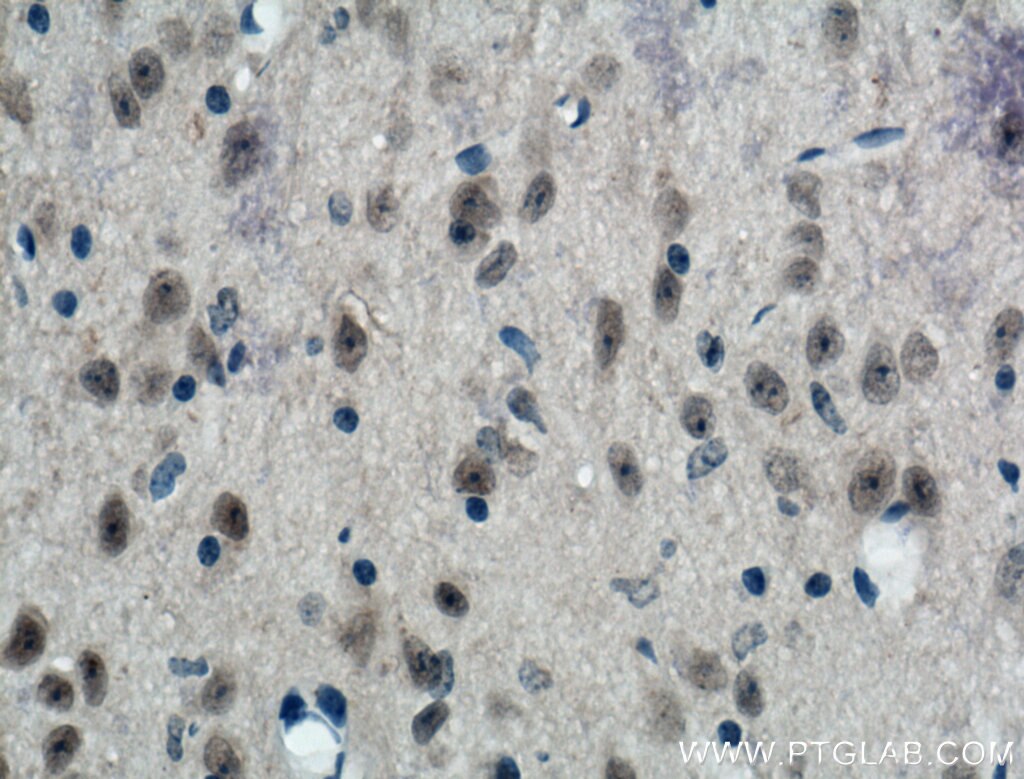 Immunohistochemistry (IHC) staining of mouse brain tissue using PRMT8 Polyclonal antibody (12557-1-AP)