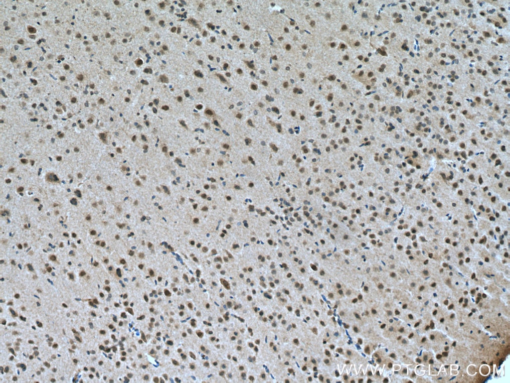 Immunohistochemistry (IHC) staining of rat brain tissue using PRMT8 Polyclonal antibody (12557-1-AP)