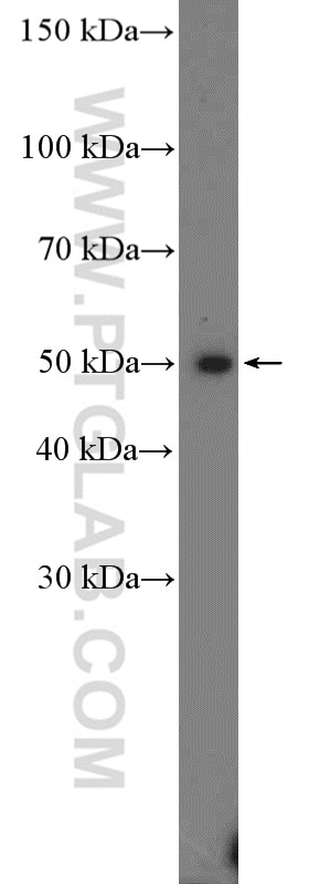 Western Blot (WB) analysis of Y79 cells using PRMT8 Polyclonal antibody (12557-1-AP)