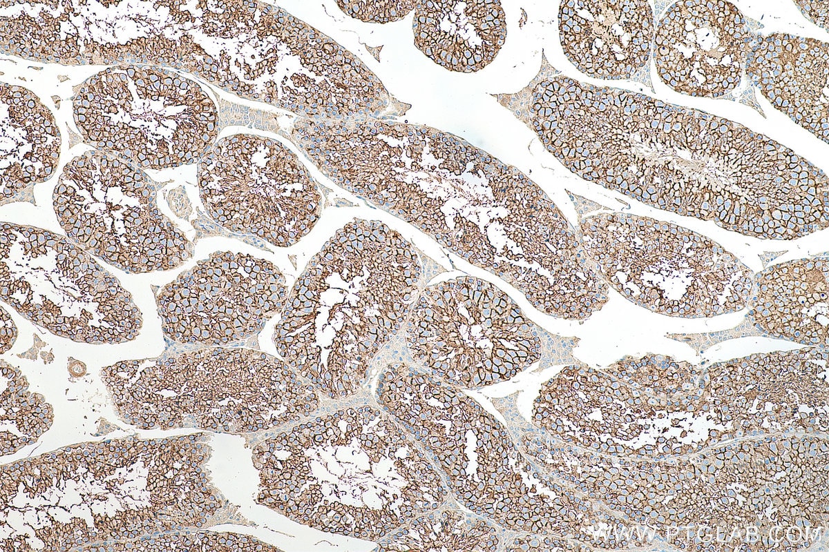 Immunohistochemistry (IHC) staining of mouse testis tissue using PRND Polyclonal antibody (26947-1-AP)