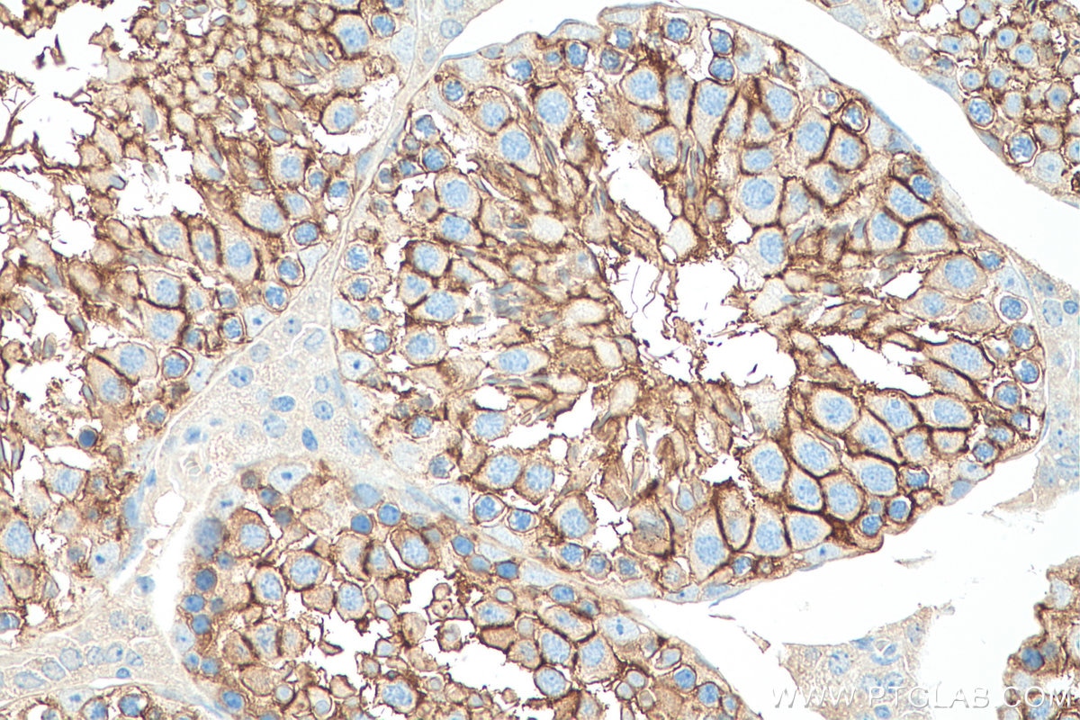 Immunohistochemistry (IHC) staining of mouse testis tissue using PRND Polyclonal antibody (26947-1-AP)