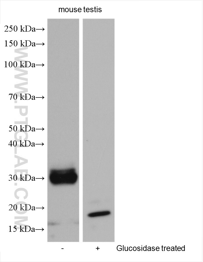 Western Blot (WB) analysis of various lysates using PRND Polyclonal antibody (26947-1-AP)