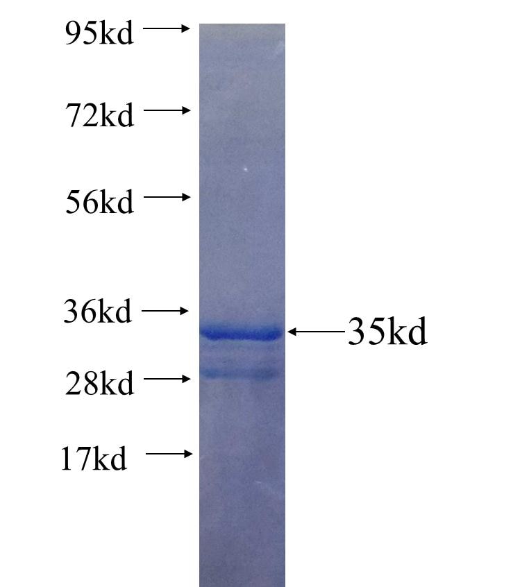PRND fusion protein Ag25435 SDS-PAGE