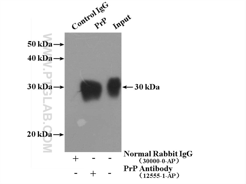 IP experiment of mouse brain using 12555-1-AP