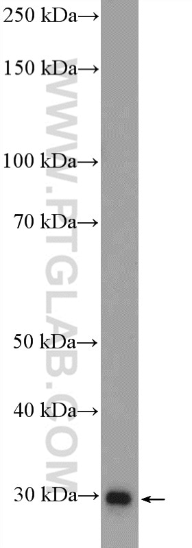 Western Blot (WB) analysis of rat brain tissue using PrP Polyclonal antibody (12555-1-AP)