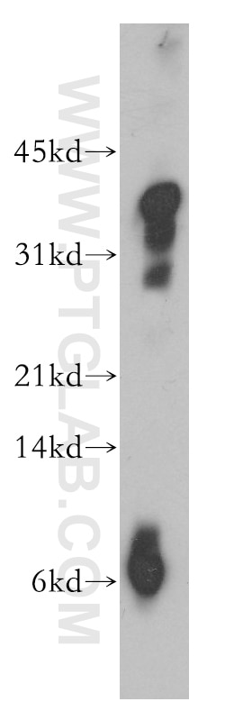 Western Blot (WB) analysis of human brain tissue using PrP Polyclonal antibody (12555-1-AP)