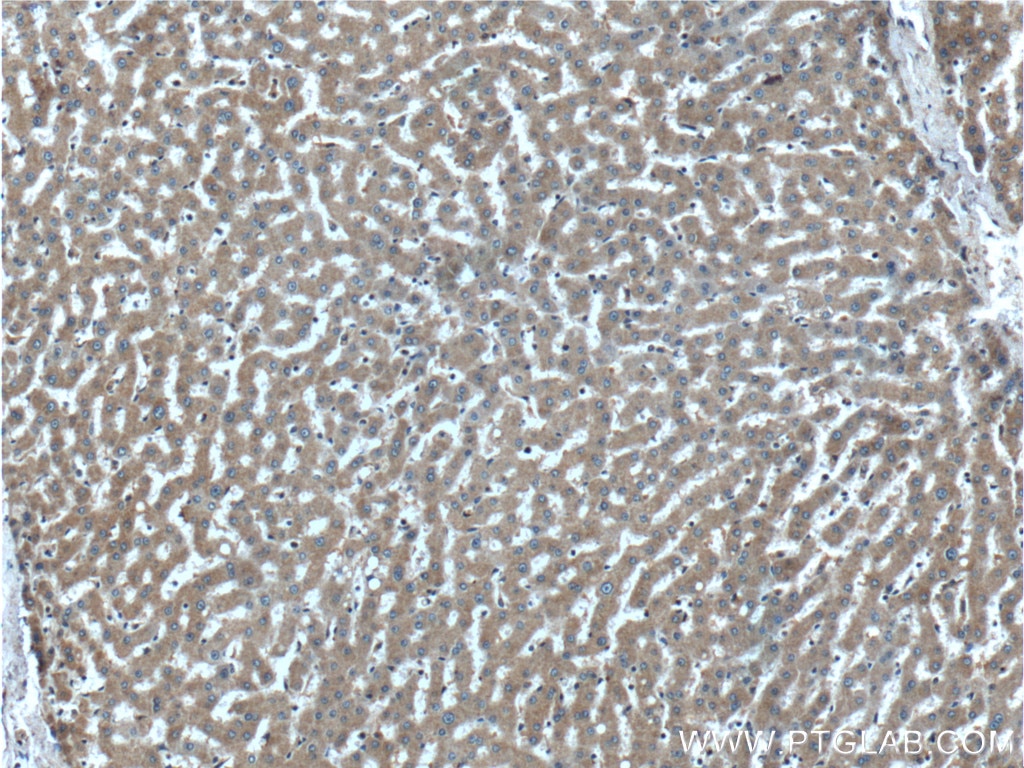 Immunohistochemistry (IHC) staining of human liver tissue using PROC Polyclonal antibody (25382-1-AP)
