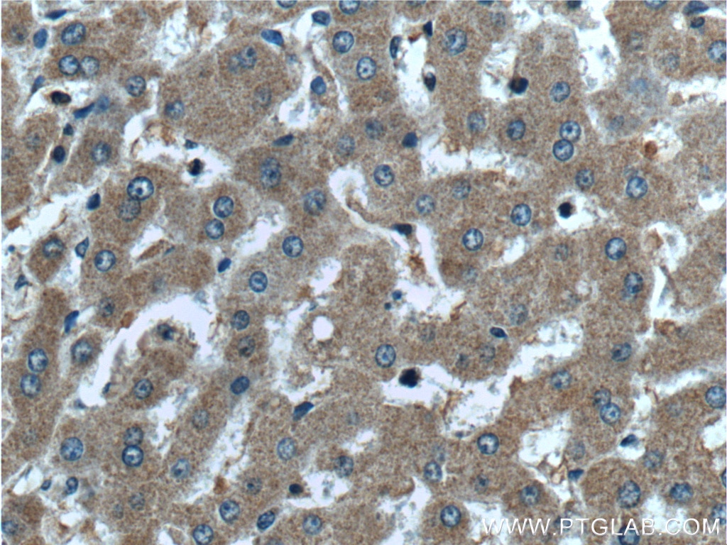 Immunohistochemistry (IHC) staining of human liver tissue using PROC Polyclonal antibody (25382-1-AP)