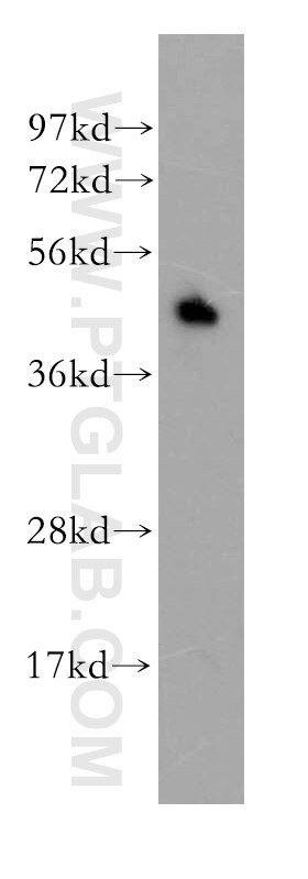 Western Blot (WB) analysis of human spleen tissue using EPCR/CD201 Polyclonal antibody (11391-1-AP)