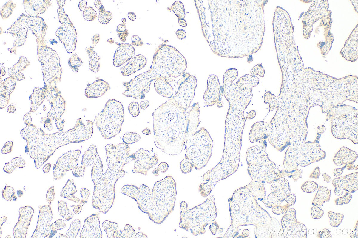 Immunohistochemistry (IHC) staining of human placenta tissue using EPCR/CD201 Polyclonal antibody (32134-1-AP)