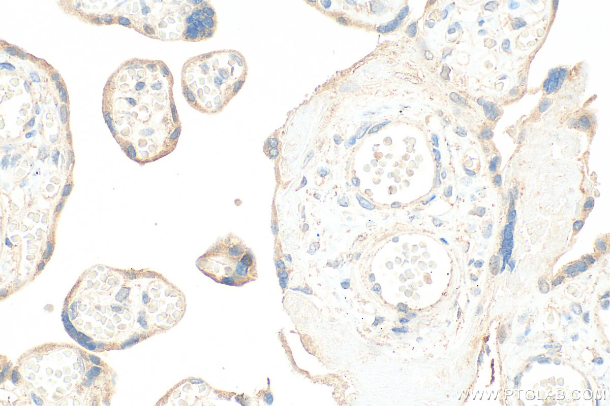 Immunohistochemistry (IHC) staining of human placenta tissue using EPCR/CD201 Polyclonal antibody (32134-1-AP)