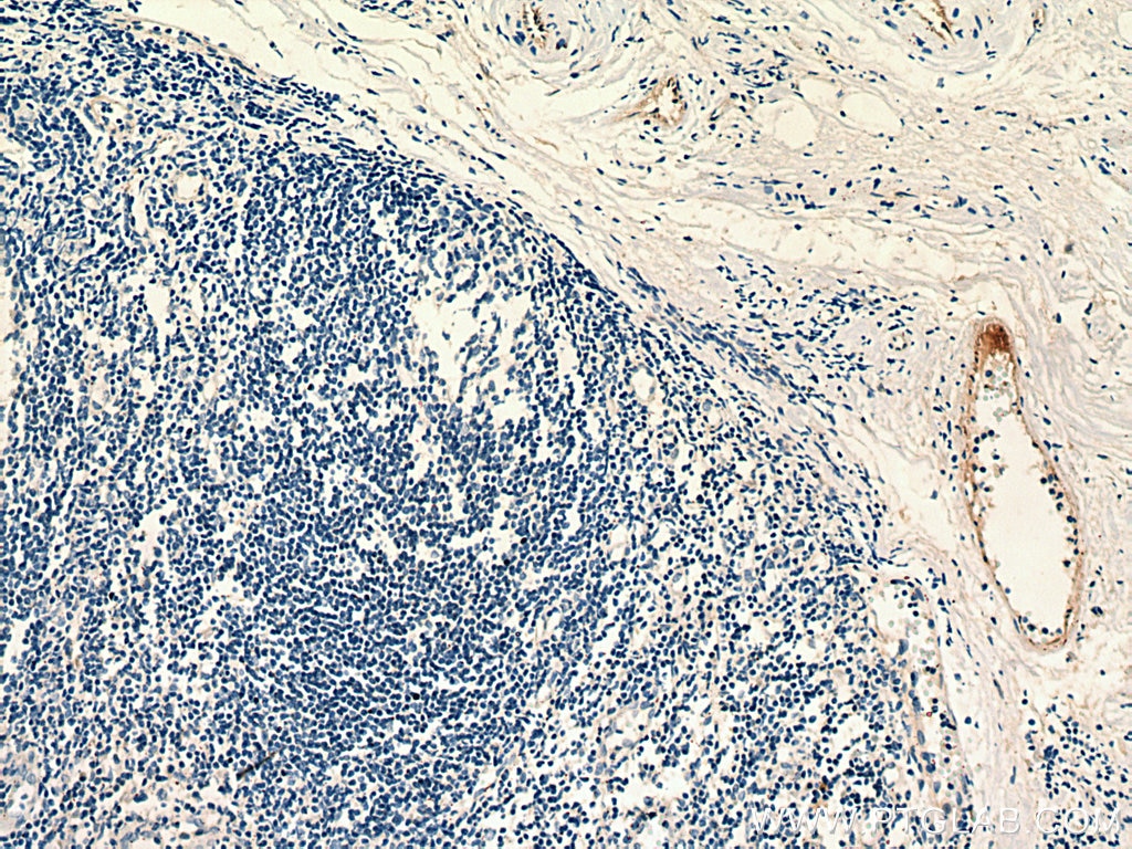 Immunohistochemistry (IHC) staining of human tonsillitis tissue using PROCR Monoclonal antibody (67658-1-Ig)