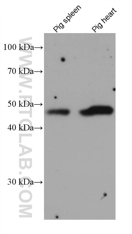 Western Blot (WB) analysis of various lysates using PROCR Monoclonal antibody (67658-1-Ig)