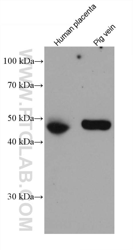 Western Blot (WB) analysis of various lysates using PROCR Monoclonal antibody (67658-1-Ig)