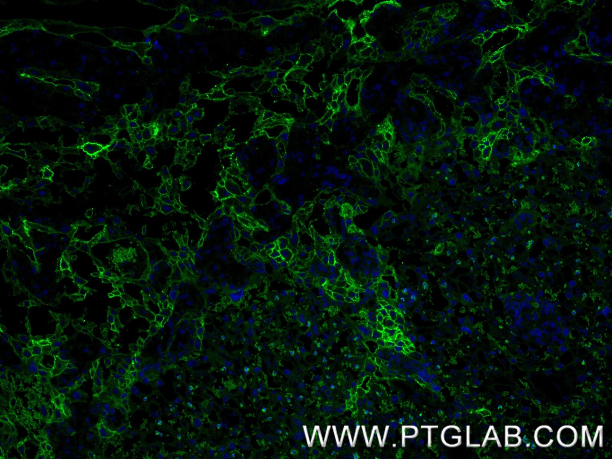 Immunofluorescence (IF) / fluorescent staining of mouse placenta tissue using EPCR/CD201 Recombinant antibody (84494-2-RR)