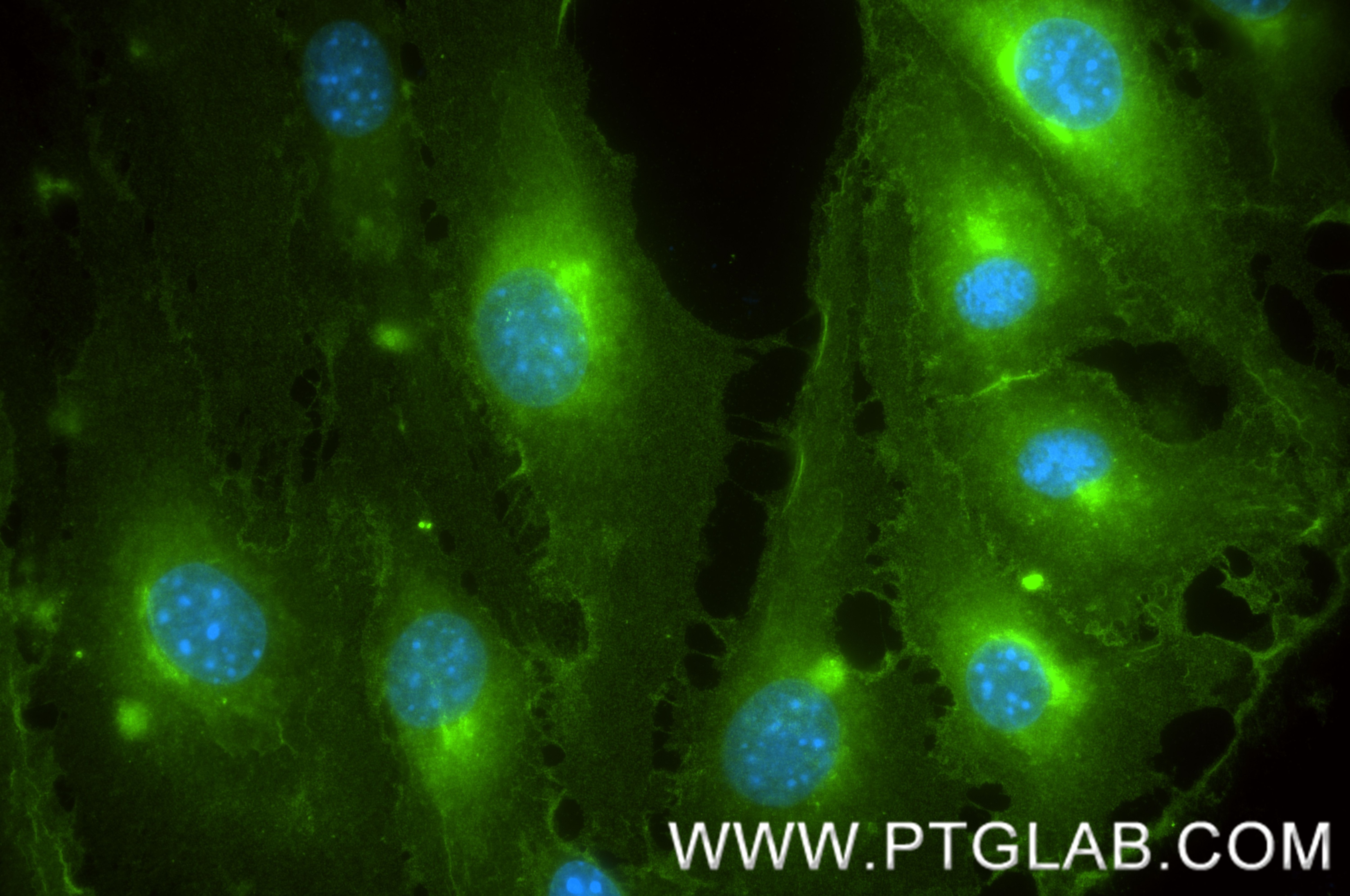 Immunofluorescence (IF) / fluorescent staining of bEnd.3 cells using EPCR/CD201 Recombinant antibody (84494-2-RR)