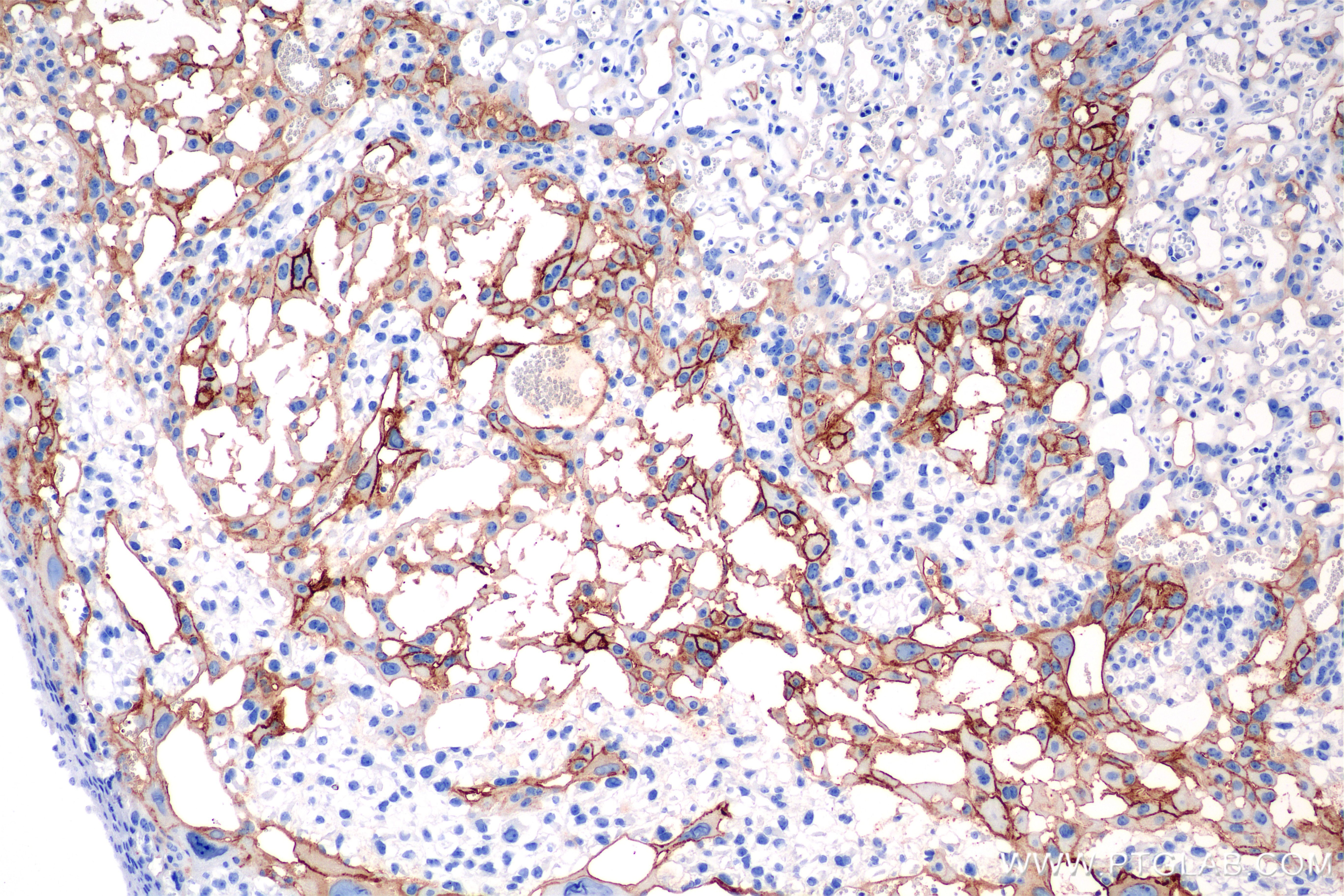 Immunohistochemistry (IHC) staining of mouse placenta tissue using EPCR/CD201 Recombinant monoclonal antibody (84494-2-RR)