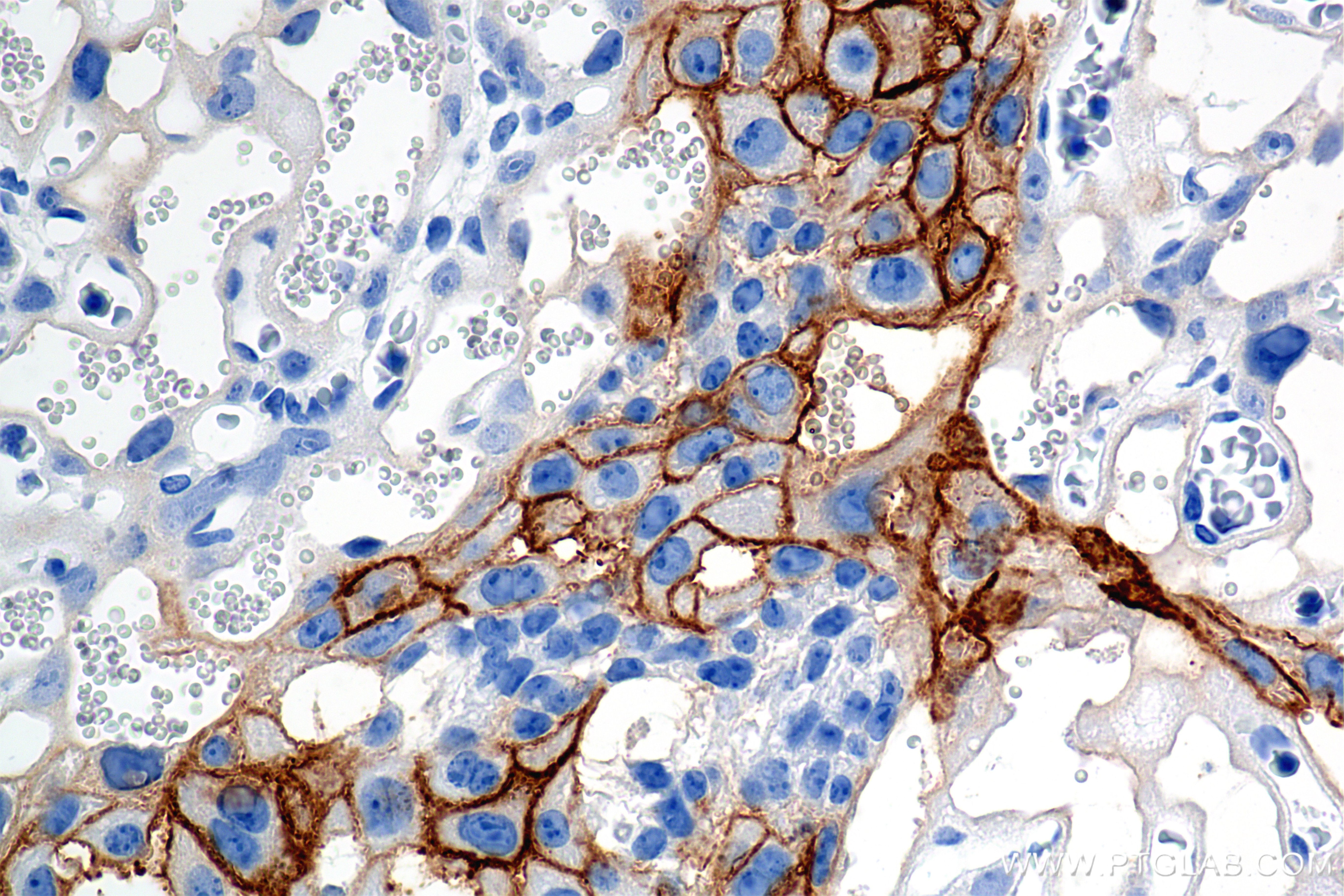 Immunohistochemistry (IHC) staining of mouse placenta tissue using EPCR/CD201 Recombinant monoclonal antibody (84494-2-RR)
