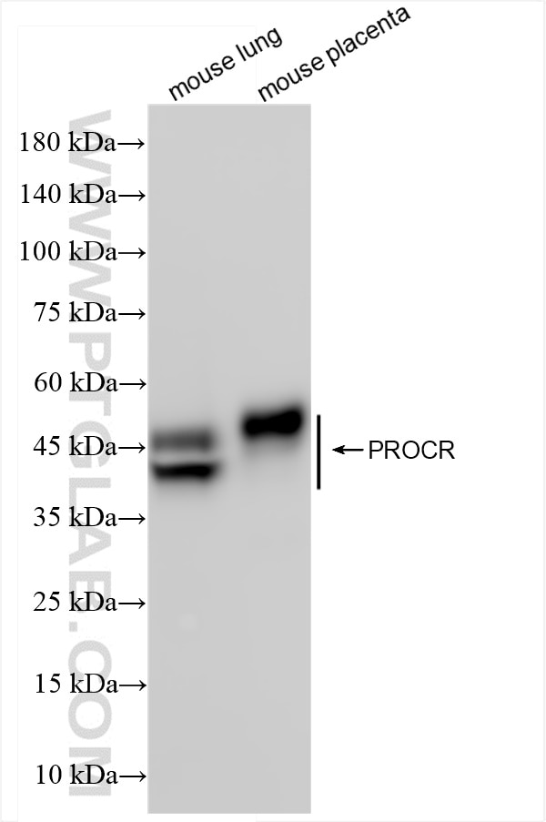 Western Blot (WB) analysis of various lysates using EPCR/CD201 Recombinant antibody (84494-2-RR)