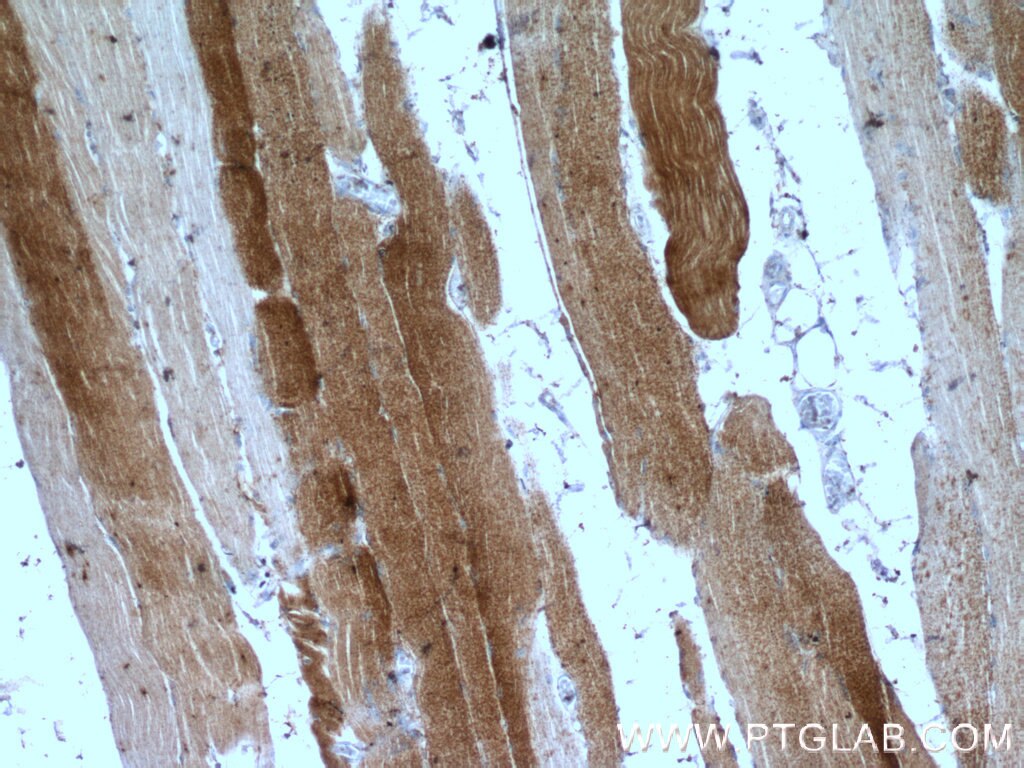 Immunohistochemistry (IHC) staining of human skeletal muscle tissue using PRODH Polyclonal antibody (22980-1-AP)