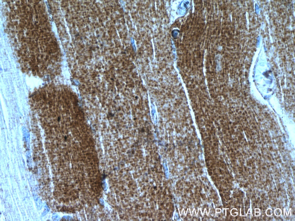 Immunohistochemistry (IHC) staining of human skeletal muscle tissue using PRODH Polyclonal antibody (22980-1-AP)