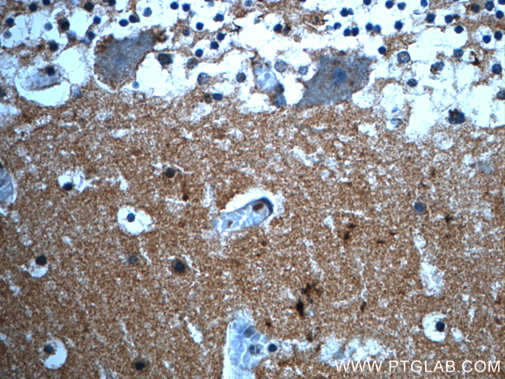 Immunohistochemistry (IHC) staining of human cerebellum tissue using PRODH Polyclonal antibody (22980-1-AP)
