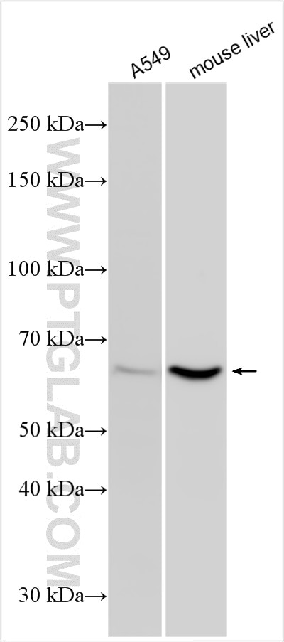 Western Blot (WB) analysis of various lysates using PRODH Polyclonal antibody (22980-1-AP)
