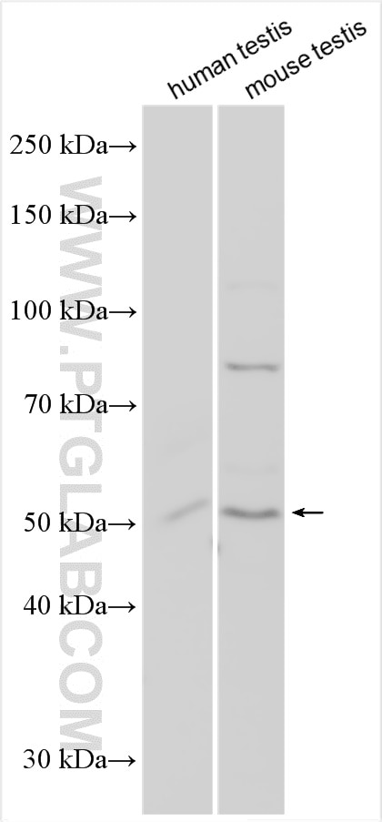 Western Blot (WB) analysis of various lysates using PRODH2 Polyclonal antibody (31047-1-AP)