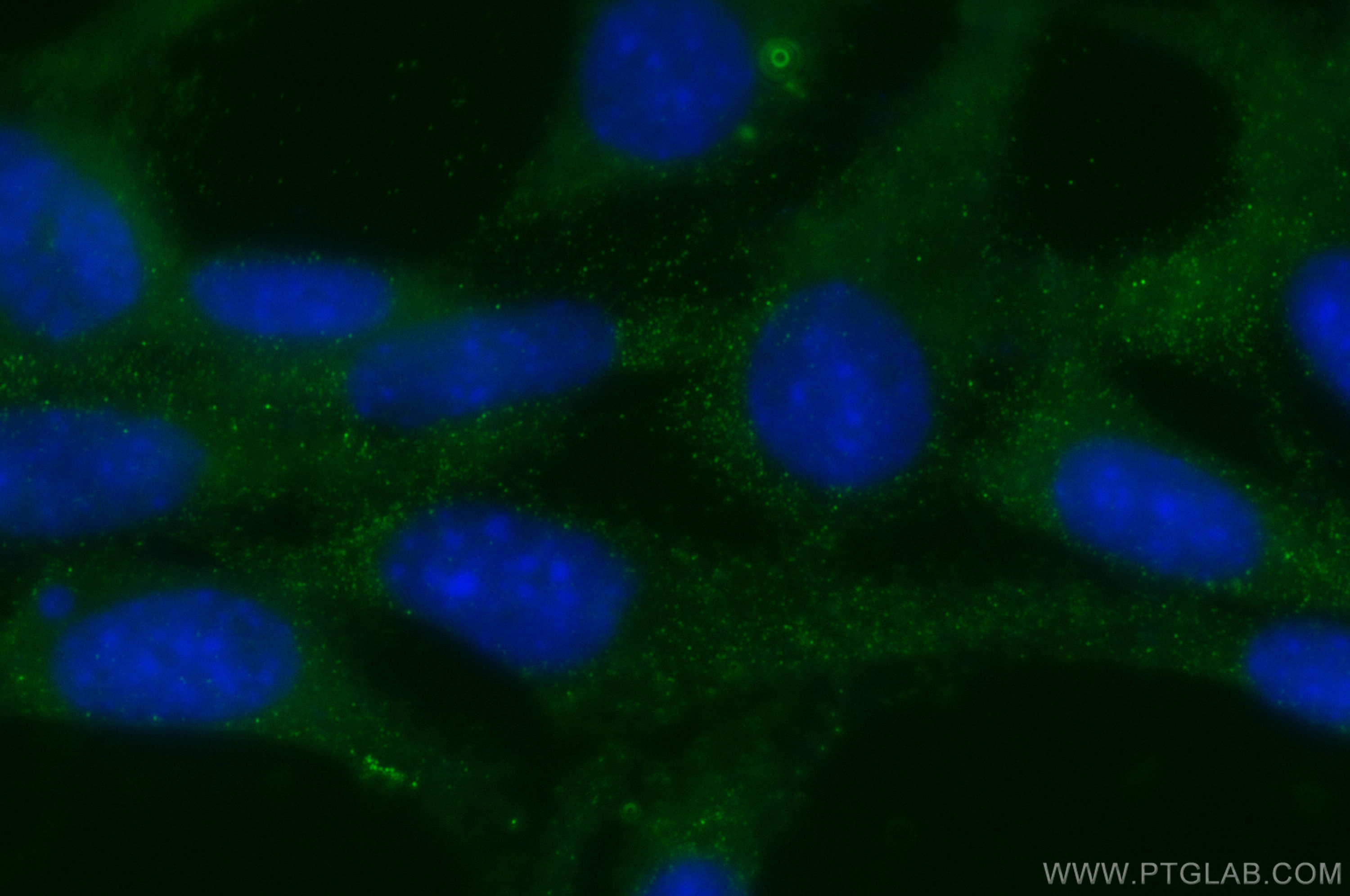 Immunofluorescence (IF) / fluorescent staining of NIH/3T3 cells using Prokineticin 1 Polyclonal antibody (15152-1-AP)