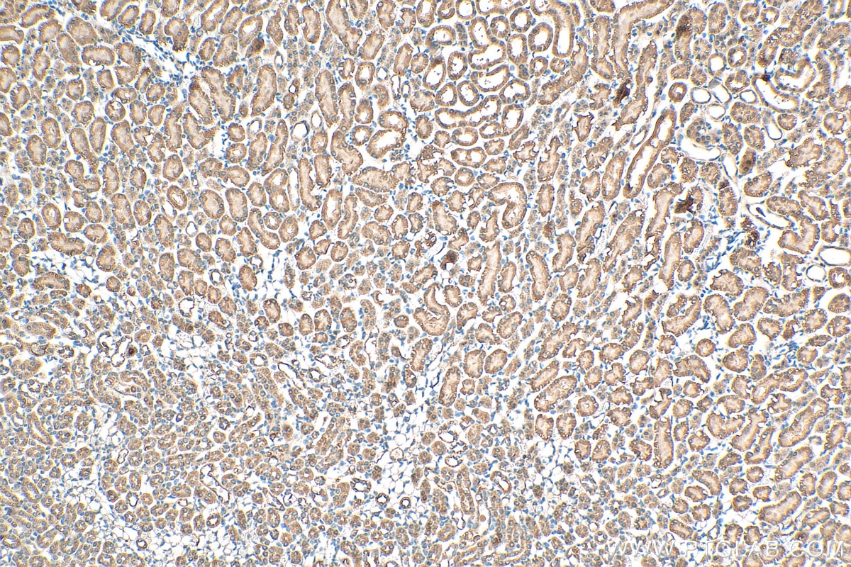 IHC staining of mouse kidney using 15152-1-AP