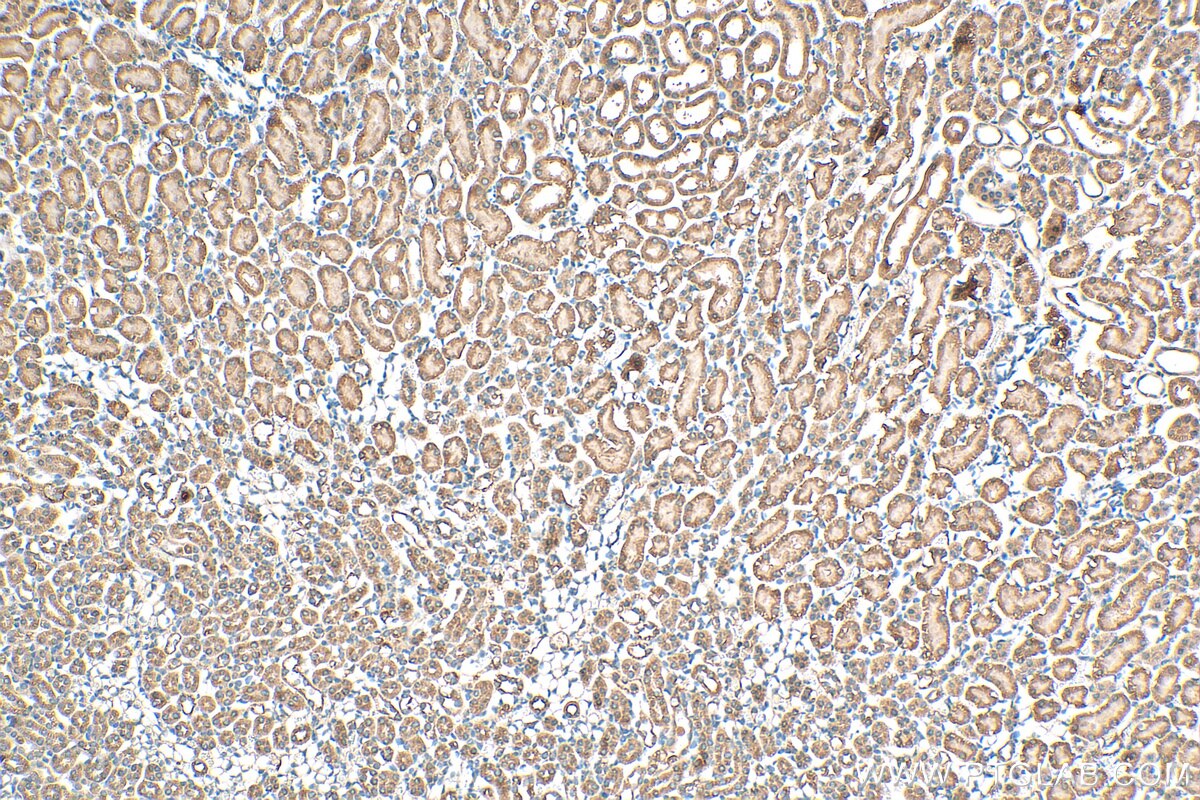 Immunohistochemistry (IHC) staining of mouse kidney tissue using Prokineticin 1 Polyclonal antibody (15152-1-AP)
