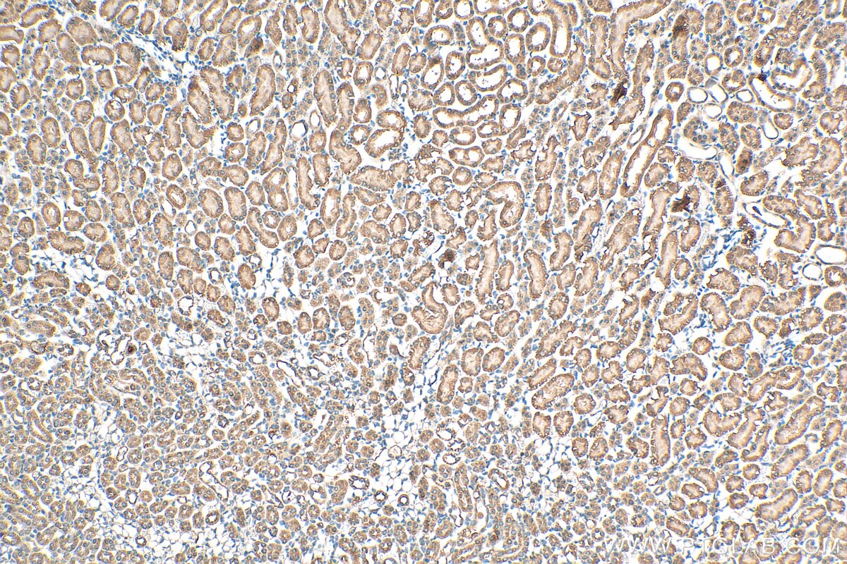 Immunohistochemistry (IHC) staining of mouse kidney tissue using Prokineticin 1 Polyclonal antibody (15152-1-AP)