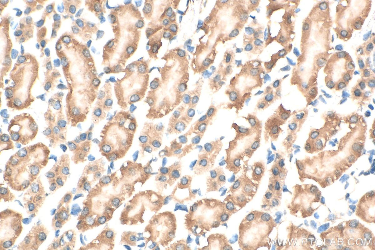 Immunohistochemistry (IHC) staining of mouse kidney tissue using Prokineticin 1 Polyclonal antibody (15152-1-AP)