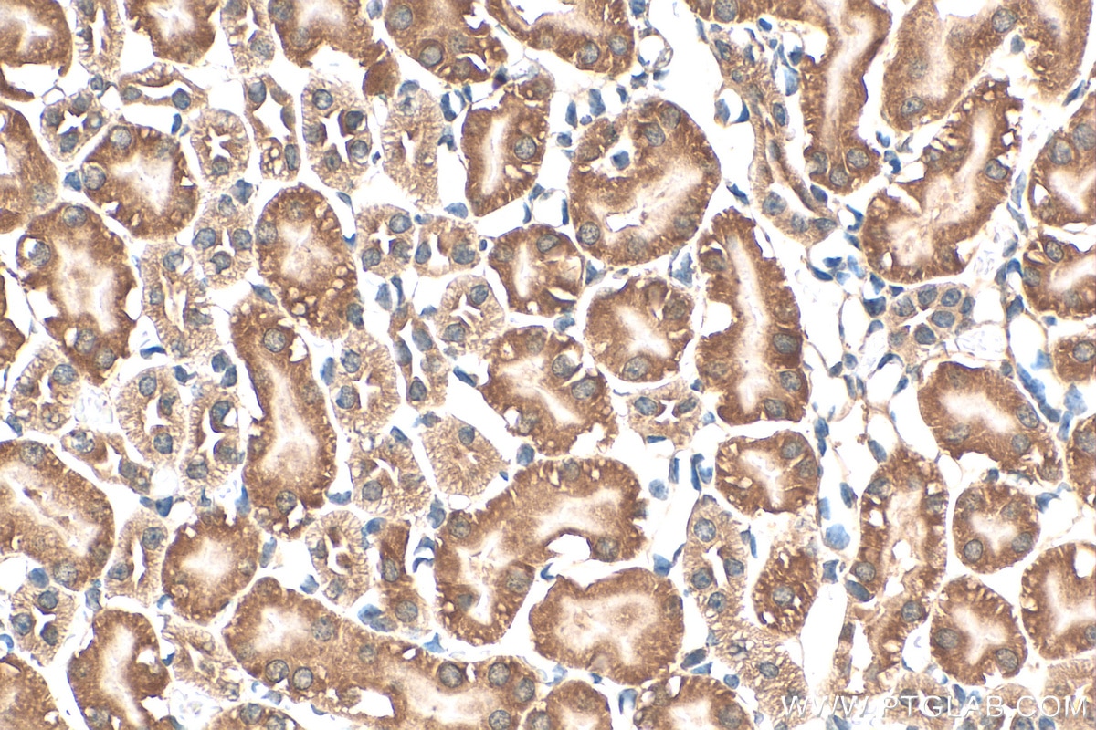 Immunohistochemistry (IHC) staining of mouse kidney tissue using Prokineticin 1 Polyclonal antibody (15152-1-AP)
