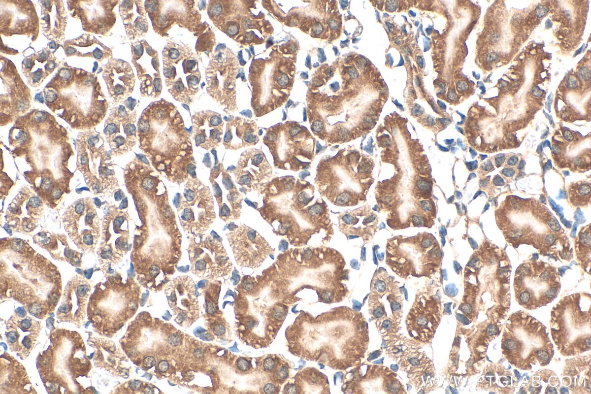 IHC staining of mouse kidney using 15152-1-AP