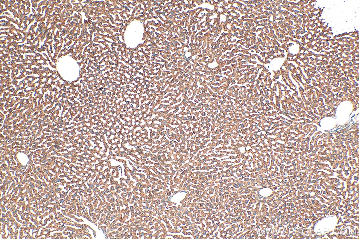 IHC staining of mouse liver using 15152-1-AP